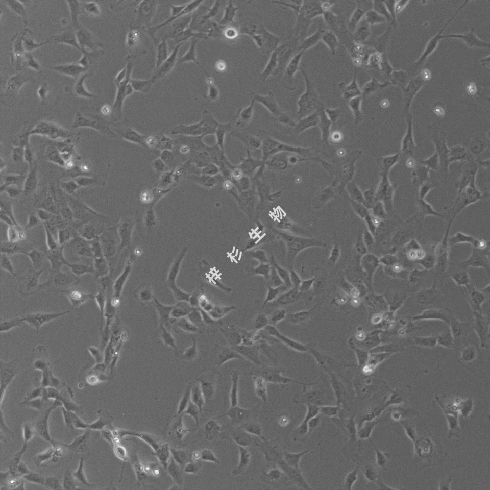 SV40T Transfected Human Umbilical Vein Endothelial Cell (PUMC-HUVEC-T1 ) Culture Medium Kit